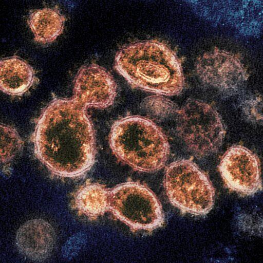 Coronavirus generic electron microscope